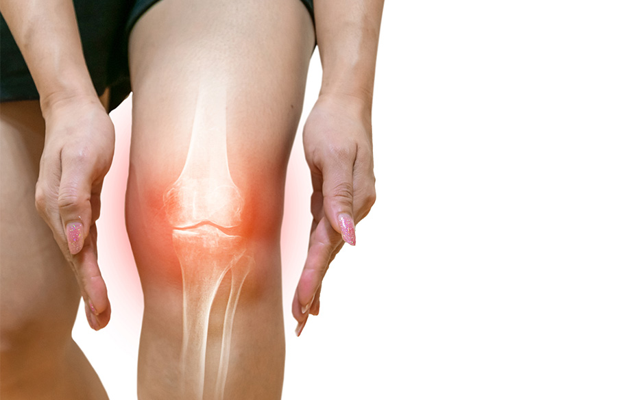 rodilla1